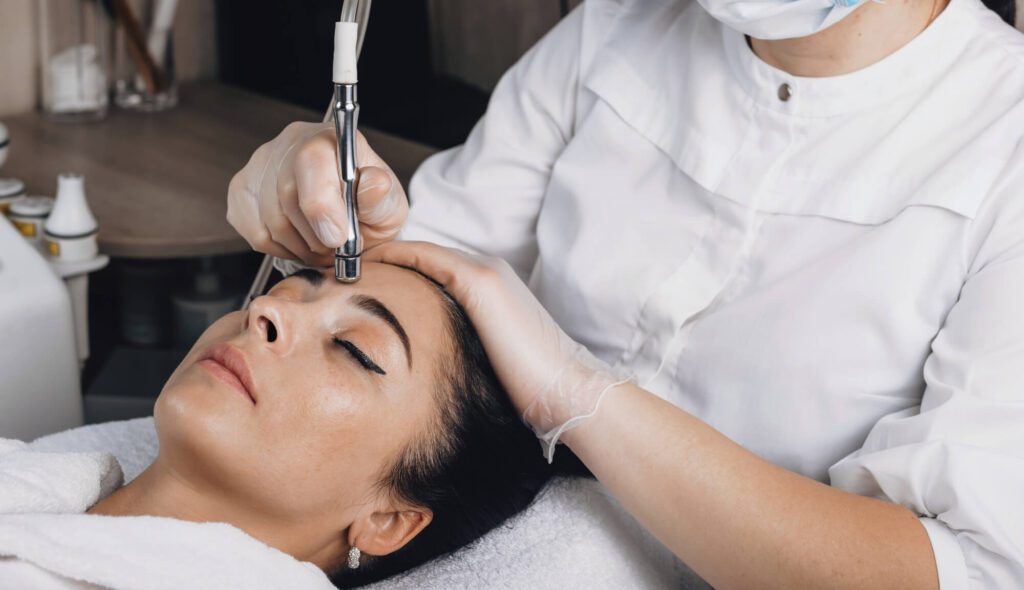microneedling